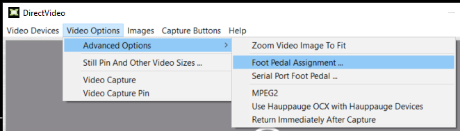 10-foot-pedal-assignment.png
